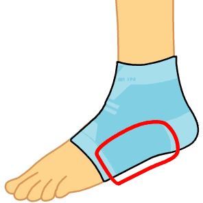 Arch Support Structure